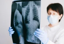 Ги разградува секретите и го олеснува дишењето: Заборавена намирница е одличен чистач на белите дробови