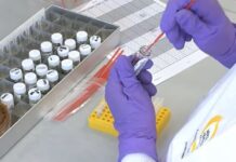 Паника на Балканот: По случаите во Романија, лепра е откриена и кај странски работник во Хрватска