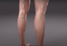 Руска каша од само 2 намирници го разбива тромбот: Спас за затнати крвни садови, проширени и воспалени вени