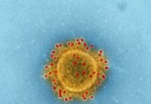 Што е неизлечивиот вирус Нипа поради кој Азија е на нозе?