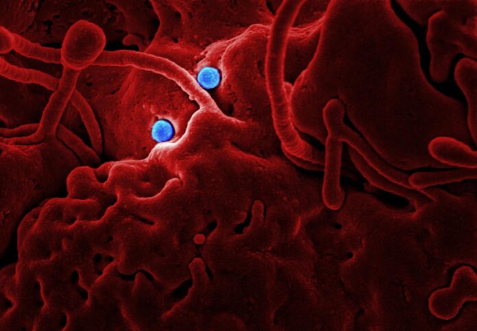 ebola pexels-cdc-library-3992930