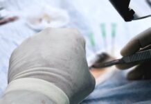 Историски подвиг: Српски лекари вградија вештачко срце кај 13-годишно момче од Сараево