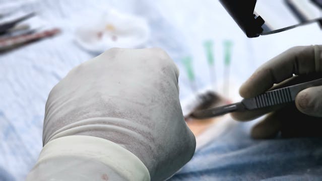 operacija transplantacija pexels-drmkhawarnazir-27138340