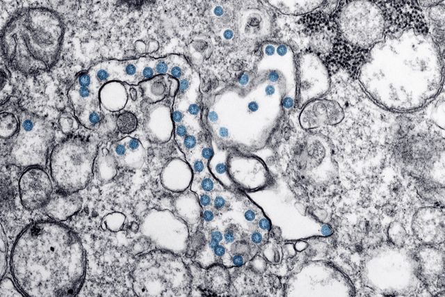 virus pexels-cdc-library-3992944